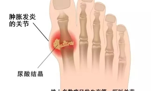 男人感冒可以怀孕-男人感冒期间要孩子的坏处网 - 男感冒要小孩有影响吗,男子感冒对备孕有没有影响